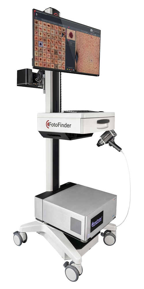 fotofinder_szures